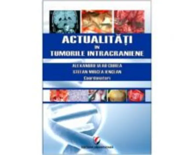 Actualitati in tumorile intracraniene - Prof. Dr. MSc. Alexandru Vlad Ciurea