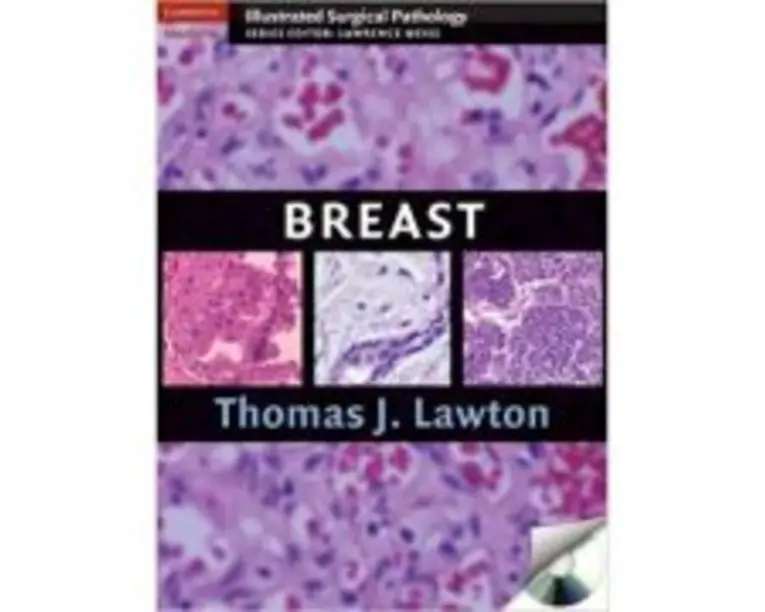 Breast - Thomas J. Lawton MD