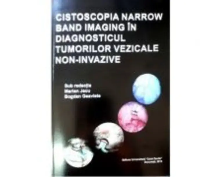 Cistoscopia narrow band imaging in diagnosticul tumorilor vezicale non-invazive - Marian Jecu, Bogdan Geavlete