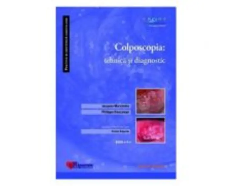 Colposcopia. Tehnica si diagnostic - Jacques Marchetta, Philippe Descamps, Corina Grigoriu