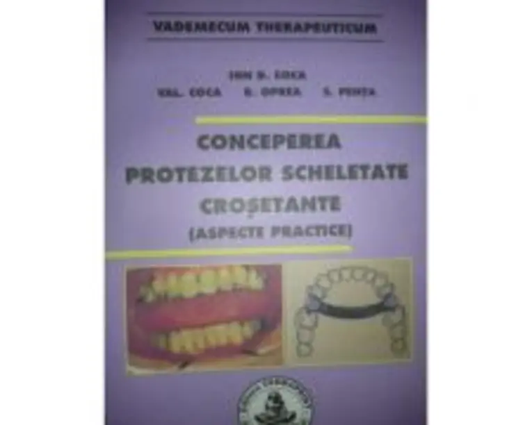 Conceperea protezelor scheletate crosetante - Ion Coca