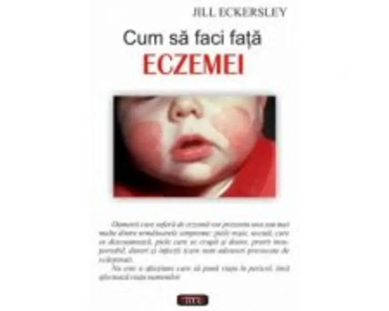 Cum sa faci fata eczemei - Jill Eckersley