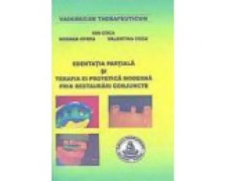 Edentatia partiala si terapia ei protetica moderna prin restaurari conjuncte - Ion Coca