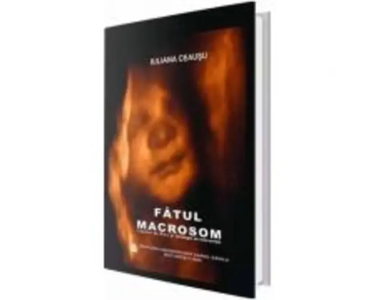 Fatul macrosom. Factori de risc si strategie de interventie - Iuliana Ceausu