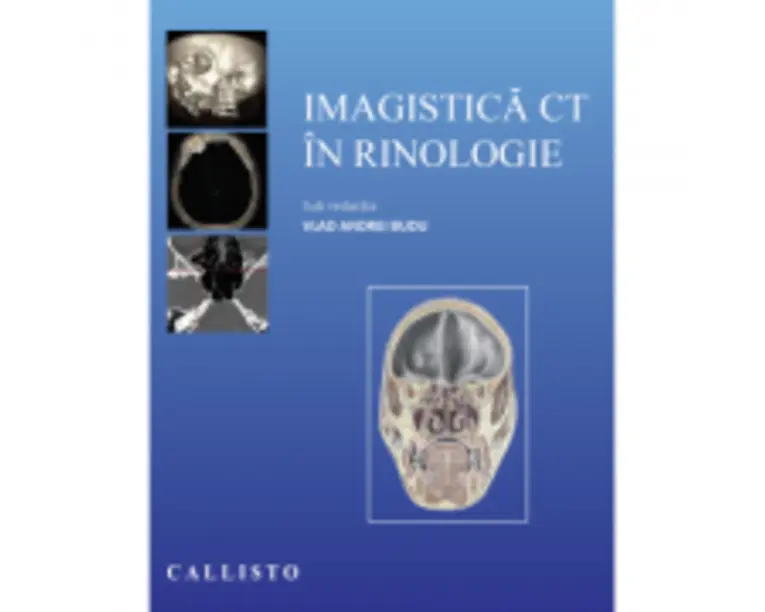 Imagistica CT in rinologie - Vlad Andrei Budu