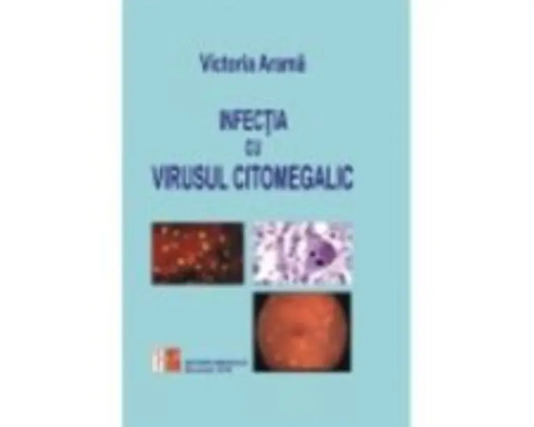 Infectia cu virusul citomegalic - Victoria Arama