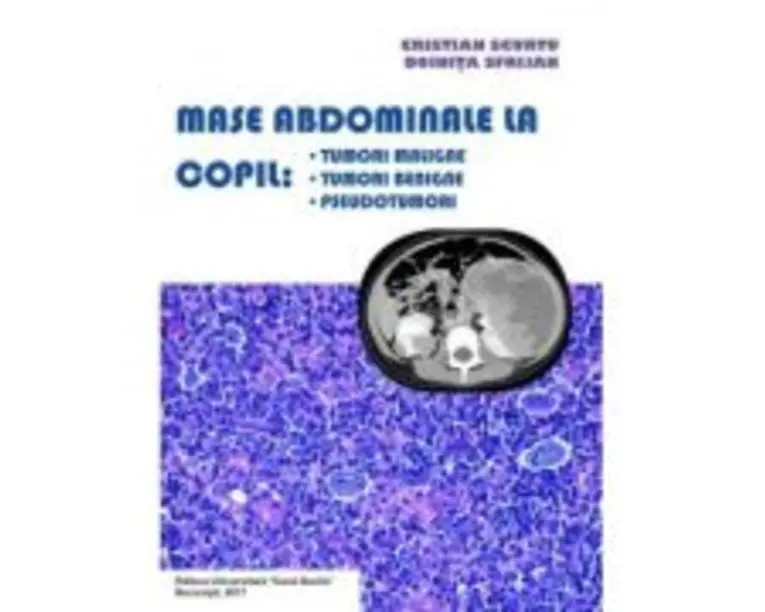 Mase abdominale la copil. Tumori maligne, tumori benigne, pseudotumori - Cristian Scurtu, Doinita Sfrijan