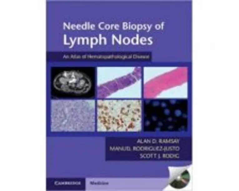 Needle Core Biopsy of Lymph Nodes with DVD-ROM: An Atlas of Hematopathological Disease - Alan D. Ramsay, Manuel Rodriguez-Justo, Scott J. Rodig