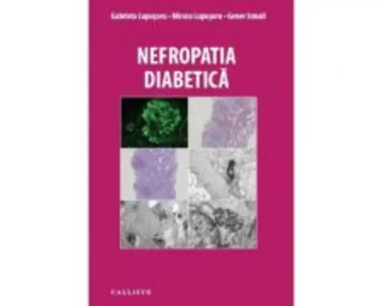 Nefropatia Diabetica - Gabriela Lupusoru, Mircea Lupusoru, Gener Ismail