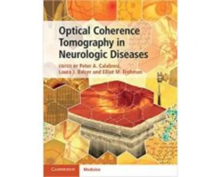 Optical Coherence Tomography in Neurologic Diseases - Peter A. Calabresi, Laura J. Balcer, Elliot M. Frohman
