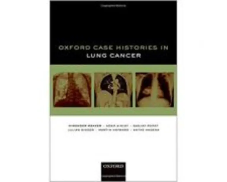 Oxford Case Histories in Lung Cancer - Himender K. Makker, Adam Ainley, Sanjay Popat, Julian Singer, Martin Hayward, Antke Hagena