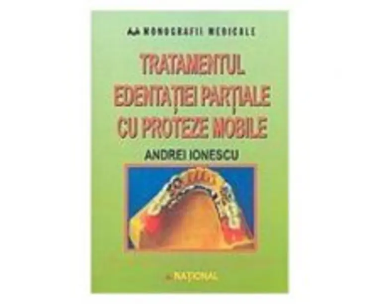 Tratamentul edentatiei partiale cu proteze mobile - Andrei Ionescu