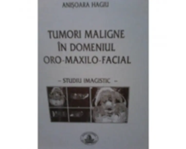 Tumori maligne in domeniul oro-maxilo-facial - Anisoara Hagiu