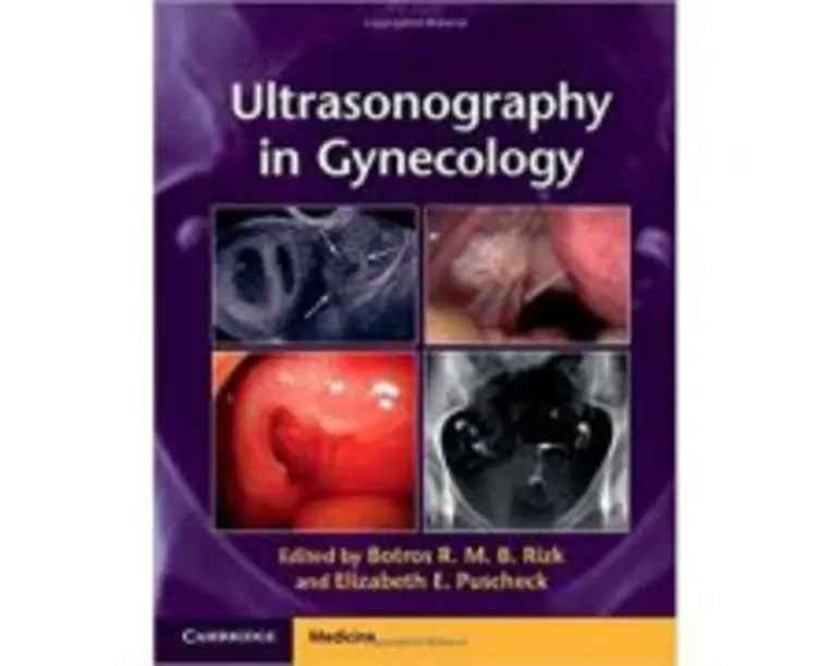 Ultrasonography in Gynecology - Botros R. M. B. Rizk, Elizabeth E. Puscheck