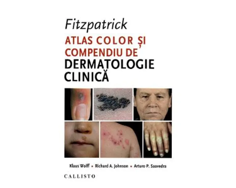 Fitzpatrick. Atlas color si compendiu de dermatologie clinica - Klaus Wolff