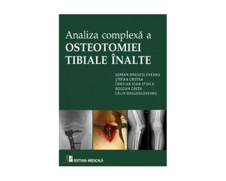Analiza complexa a Osteotomiei Tibiale Inalte - Serban Dragosloveanu
