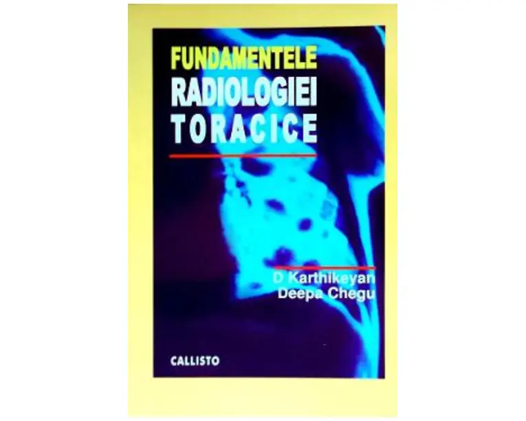 Fundamentele radiologiei toracice - D. Karthikeyan, Deepa Chegu