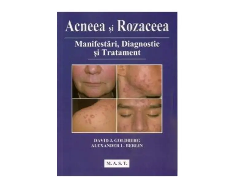 Acneea si rozaceea - David J. Goldberg
