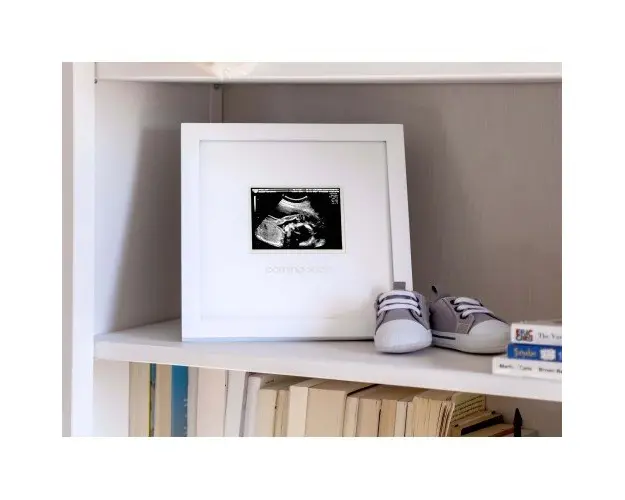 Rama foto pentru pastrarea ecografiei Pearhead